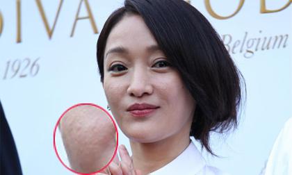 Soi cận gương mặt sần sùi, rỗ lỗ chỗ của Châu Tấn