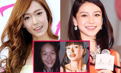 Sao 'hóa thiên nga' nhờ niềng răng