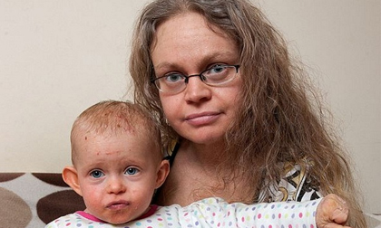 Người phụ nữ thay da nhanh như... động vật