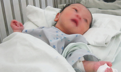 Phía sau hành động mẹ cắn đứt ngón tay con mới sinh