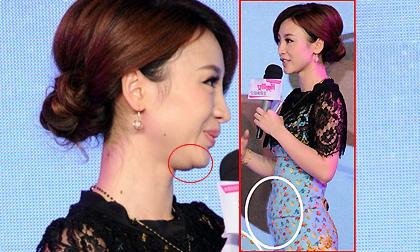 Liễu Nham "phát tướng" với "hai cằm" và bụng to gây nghi vấn