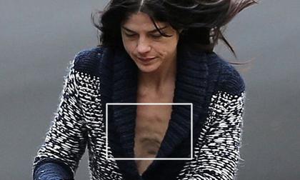 "Phát hoảng" với thân hình "trơ xương" của sao nữ Hollywood