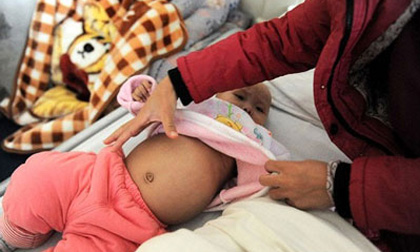 Con 10 tháng tuổi bị ung thư, bố ôm tiền chạy trốn