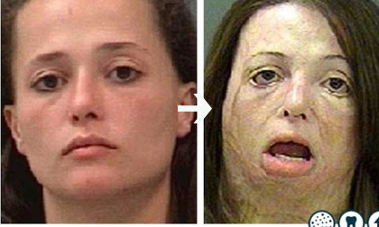 Những dung nhan bị phá hủy khủng khiếp do ma túy