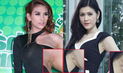 8 vụ lộ sẹo nâng ngực 'nóng' nhất 2012