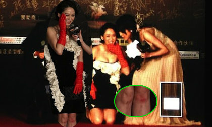 Trần Kiều Ân "đỏ cả mặt cả chân" vì ngã dập đầu gối