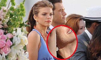 Kiều nữ Hollywood lộ da cóc sần sùi