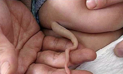 10 bức ảnh gây sốc về đuôi… người