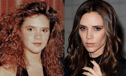 Lý giải khuôn mặt Victoria từ tròn trịa sang góc cạnh