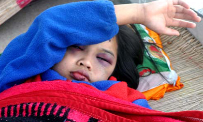 Nỗi khổ trần gian của bé 3 tuổi đã bị mẹ bỏ rơi