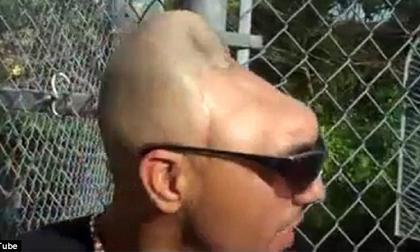 Rùng mình với đầu người như quả bóng bẹp