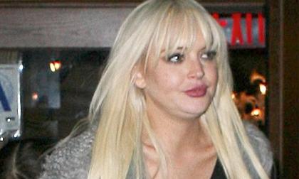 Mặt Lindsay Lohan bỗng biến dạng sưng húp