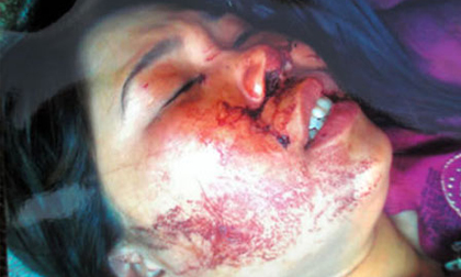 Hành hung, dùng dao lam rạch chỗ kín