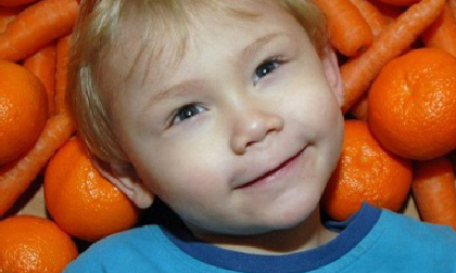 Bỗng dưng trở thành cậu bé “da cam” vì ăn cà rốt