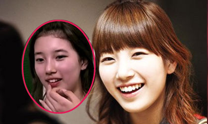 Suzy (Miss A) thừa nhận đã "nắn chỉnh" hàm răng