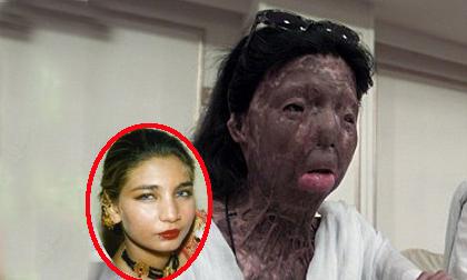 Người phụ nữ tồn tại suốt 12 năm với khuôn mặt 'quái vật'