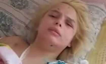 Phẫn nộ thiếu nữ bị hiếp dâm tập thể rồi đốt sống