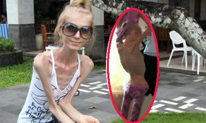 "Rùng mình" trước sự giảm cân của một cô gái xinh đẹp