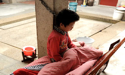 Bé trai 12 tuổi bị mẹ nuôi dùng xích trói cổ