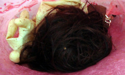 Kinh hãi những vụ đánh ghen lìa da đứt thịt