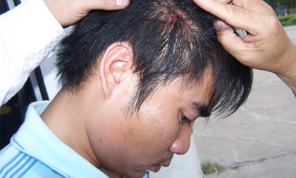 CSGT dừng xe cho côn đồ đánh tài xế?