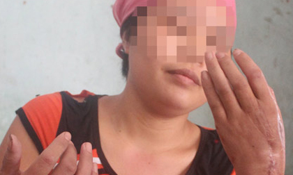 Vĩnh Phúc: Chồng tự chặt tay rồi điên cuồng truy sát vợ