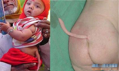 BST những người mọc đuôi kì dị trên thế giới