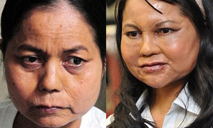 “Cô gái hóa bà lão” đã phẫu thuật thẩm mỹ tại Đài Loan