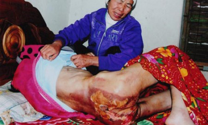 Bà chủ bạo hành ô sin như thời trung cổ 'bóc lịch' 18 tháng