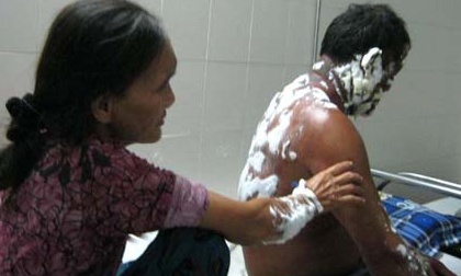 Cháu gái châm lửa đốt vợ chồng bác ruột