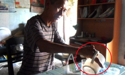 Gia đ&#236;nh nhiều đời, ch&#226;n tay chỉ c&#243; 1 ng&#243;n : C&#243; hay kh&#244;ng mối li&#234;n hệ với tộc người kỳ b&#237; ở ch&#226;u Phi?