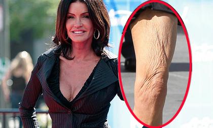 Cựu siêu mẫu xuống đường với đôi chân nhăn nhúm kinh dị