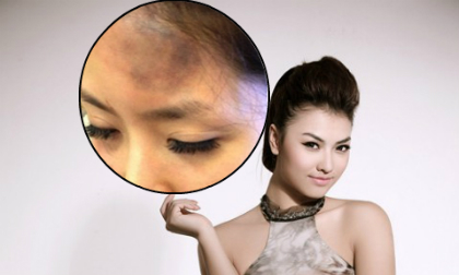 Sao đánh người có phải xin lỗi?