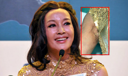 Lưu Hiểu Khánh lộ vùng... 'cánh' nhăn nhúm