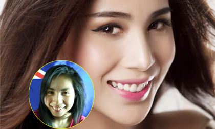 Mỹ nữ "lên đời" nhan sắc nhờ... răng