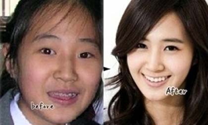 Những sao Hàn dính nghi án phẫu thuật thẩm mỹ