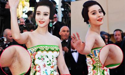 Những mỹ nhân từng 'muối mặt' vì 'vùng cánh' thiếu thẩm mỹ