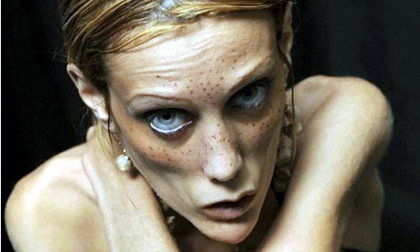 Những người mẫu gây tranh cãi nhất thế giới