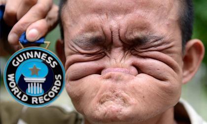 Dị nhân Trung Quốc có thể tự cắn mũi của mình