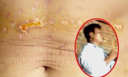 Hoảng hồn cách đuổi tà bằng chích nhang, đá vào vùng kín