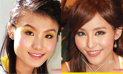 Những kiều nữ Hong Kong dính nghi án "gọt cằm"