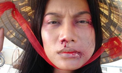 Khi sao Việt "bầm dập"