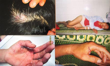 Đoạn tình, cả nhà chém con gái nuôi