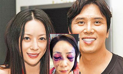 Sốc với gương mặt người mẫu Đài Loan bị đánh