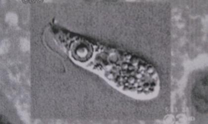 "Amip ăn não người": Dư luận lo lắng, chuyên gia trấn an