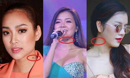 Sao Việt "nổi như cồn" nhờ nốt ruồi ở cổ?