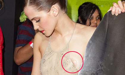 Emma Watson lộ miếng dán ngực