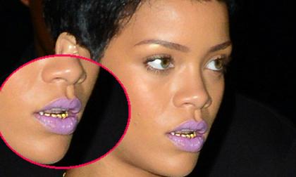 Rihanna "gây hoảng" với răng vàng khè, môi tím ngắt