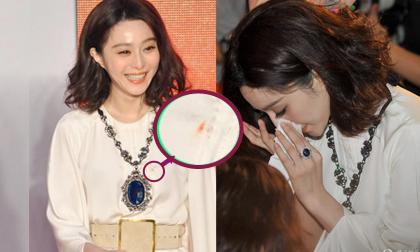 Phạm Băng Băng bị chảy máu cam dính cả ra váy