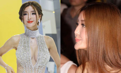 Sao hết chối bay khi lộ dấu vết dao kéo